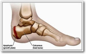 Child Heel - Growth Plate